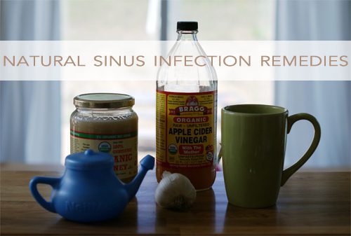 You are currently viewing Natural Sinus Infection Remedies