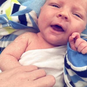 Read more about the article Ichthyosis {or fish-scale disease} and what it means for our little one