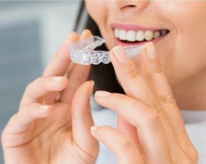 Read more about the article Signs You’re a Good Candidate for Invisalign in Malaysia