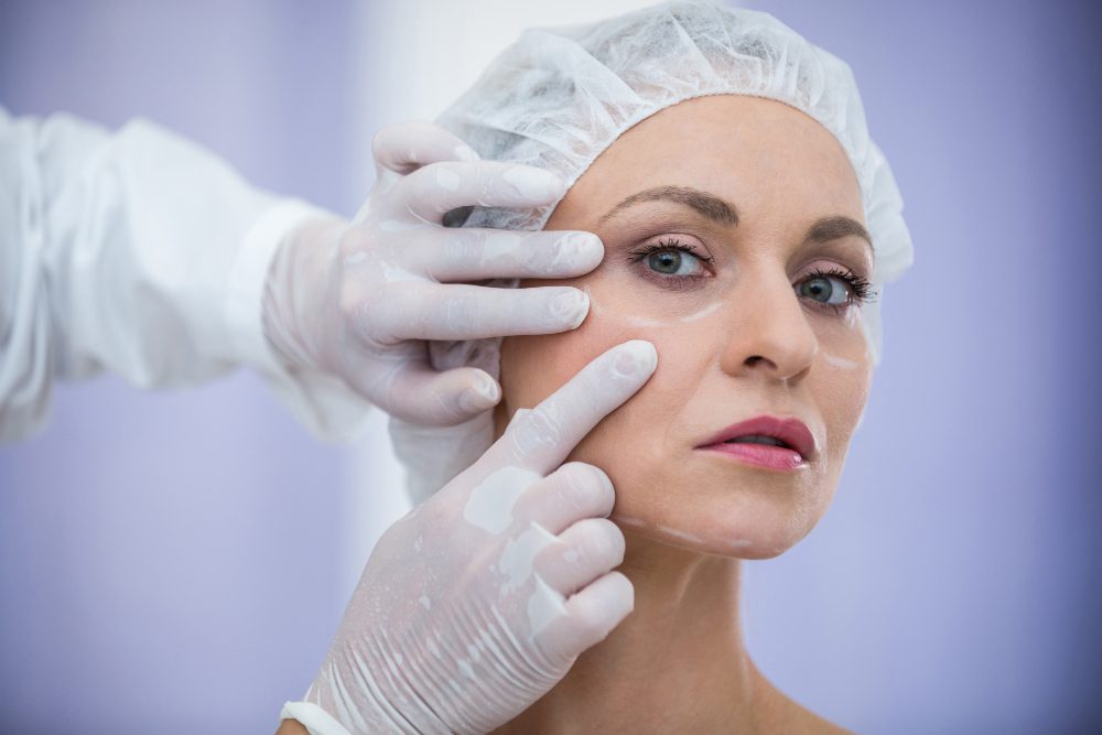 You are currently viewing Short Scar Facelift vs. Traditional Facelift: Which is Right for You?