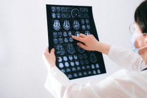 Read more about the article Healing Minds, Restoring Lives: Meet the Brain and Spinal Injury Lawyer