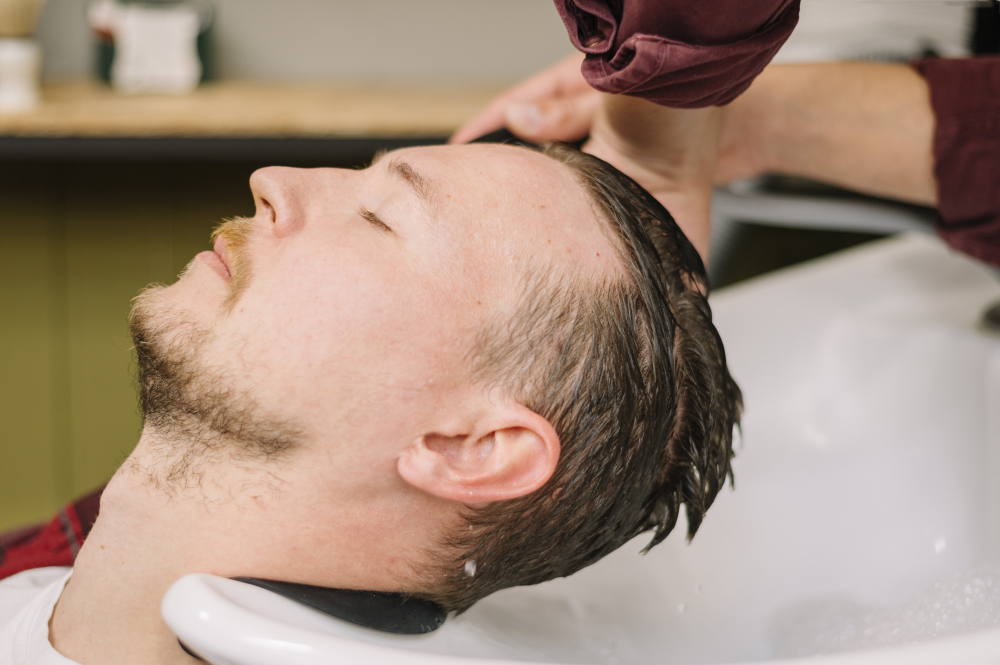 You are currently viewing Best Hair Loss Treatment for Men: What Works and What Doesn’t