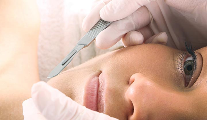 What Does Precision Exfoliation In Dermaplaning Do? 