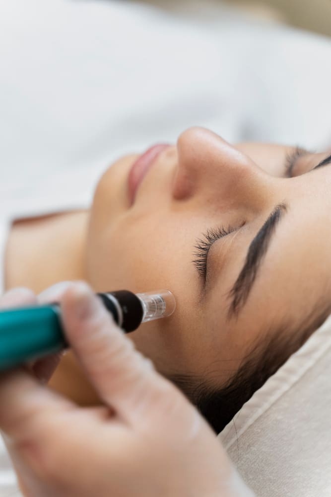 What Should I Do After Microneedling to Minimize Downtime and Maximize Benefits?